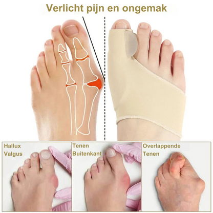 Ortho Toe Straightener