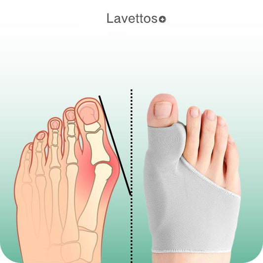Ortho Toe Straightener